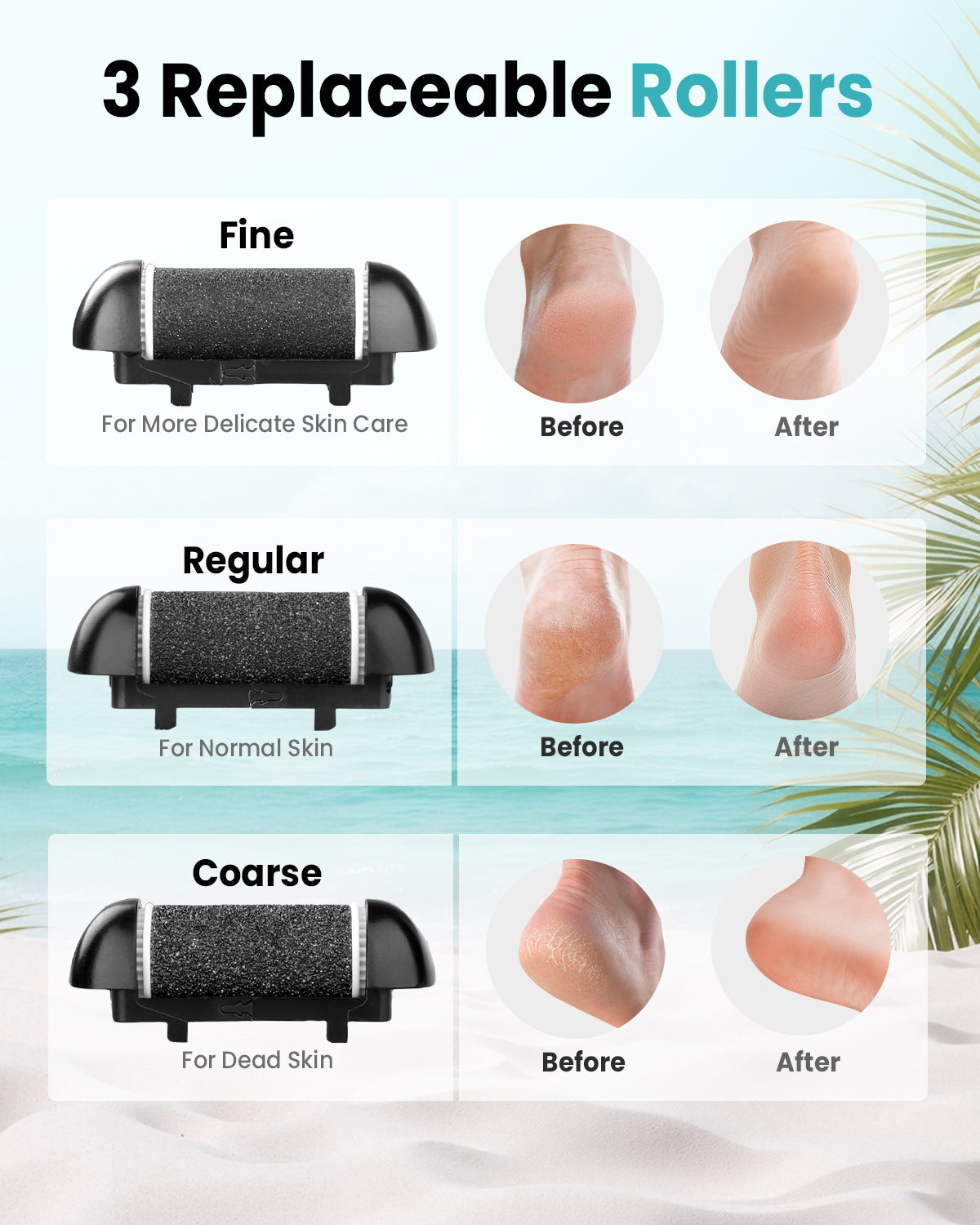 Electric Foot Callus Remover