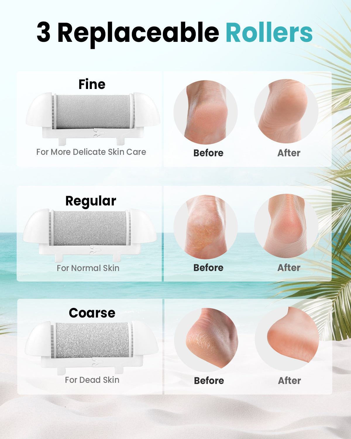 Electric Foot Callus Remover